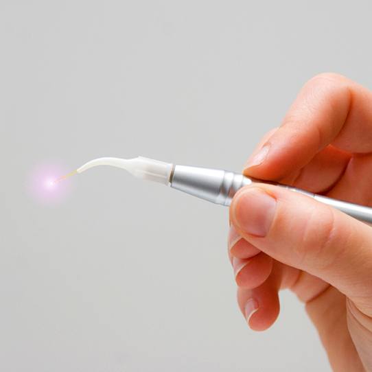 Hand holding soft tissue laser hand tool