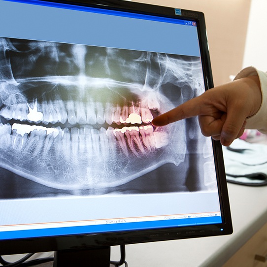 Dentist pointing to digital x-rays on computer screen