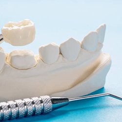 Dental crown and mold of mouth