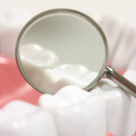Dentist examining child's smile after placing dental sealants