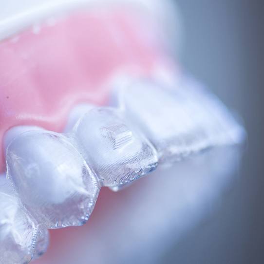 Understanding the cost of Invisalign