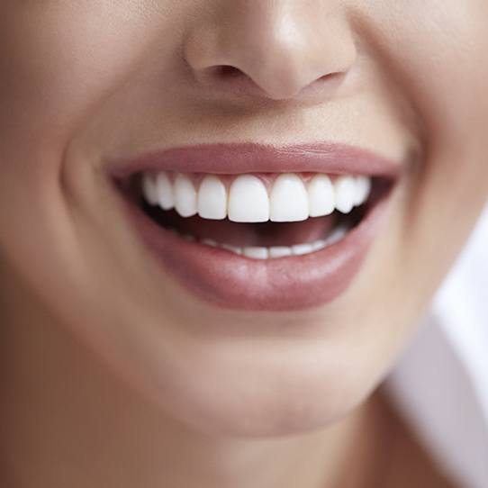 Closeup of patient's smile after tooth colored filling treatment