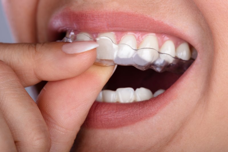 A woman placing SureSmile aligners on her teeth